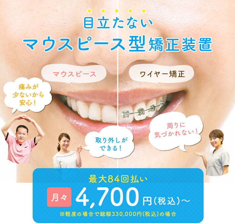 目立たない・安いマウスピース型矯正装置なら大阪市のみやけ歯科医院へ